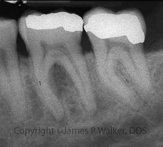 Molar